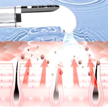 Aspirateur Points Noirs | HySkin™️