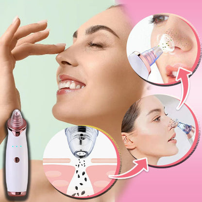 ASPIRATEUR POINTS NOIRS | NettoSkin™