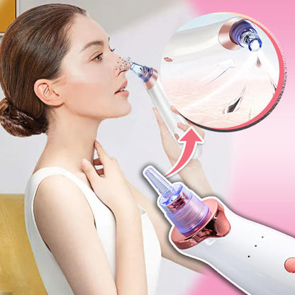 ASPIRATEUR POINTS NOIRS | NettoSkin™