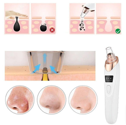 AspiNet™ | ASPIRATEUR ÉLECTRIQUE DE POINTS NOIRS & PORES - Allure de Charme