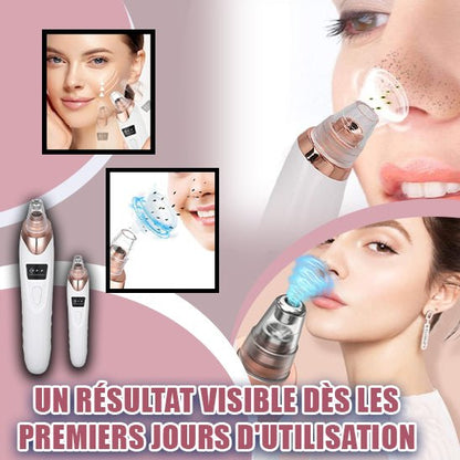 AspiNet™ | ASPIRATEUR ÉLECTRIQUE DE POINTS NOIRS & PORES - Allure de Charme