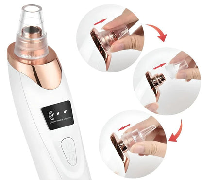 AspiNet™ | ASPIRATEUR ÉLECTRIQUE DE POINTS NOIRS & PORES - Allure de Charme