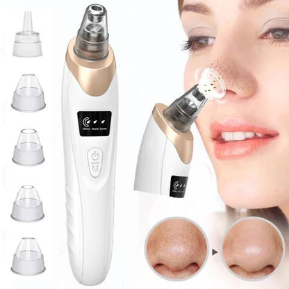AspiNet™ | ASPIRATEUR ÉLECTRIQUE DE POINTS NOIRS & PORES - Allure de Charme