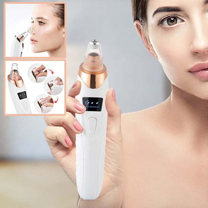 AspiNet™ | ASPIRATEUR ÉLECTRIQUE DE POINTS NOIRS & PORES - Allure de Charme